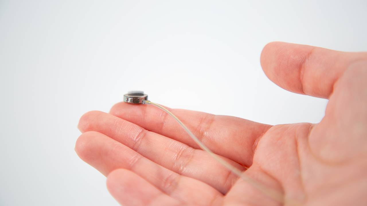 Paradromics avanza en el desarrollo de un chip cerebral para implantar en humanos llamado Connexus